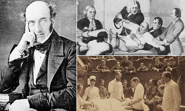 2. 1847 yılında Robert Liston isimli bir doktor, sadece 25 saniye içerisinde uzuv kesme ameliyatı gerçekleştiriyordu.