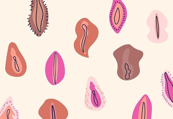 Barbie vajina operasyonunda iç dudaklar ve klitoris tümsekçiği en yüksek oranda küçültülür.