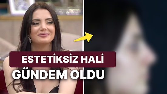 Bir Estetik Haberi Daha: Kısmetse Olur Elif'in Estetiksiz Fotoğrafı Ortaya Çıktı