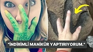 Her İki Elinde de 3 Parmağı Olan Kadından Açıklamalar: "Manikürcüler Yüzde 40 İndirim Yapıyorlar!"