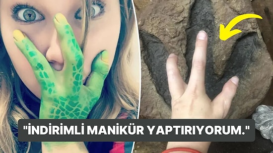 Her İki Elinde de 3 Parmağı Olan Kadından Açıklamalar: "Manikürcüler Yüzde 40 İndirim Yapıyorlar!"