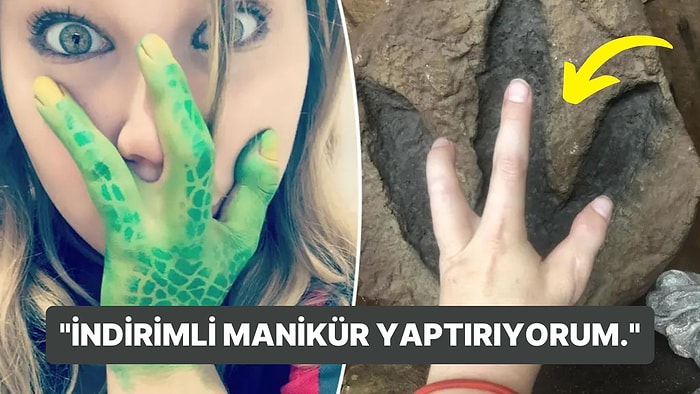 Her İki Elinde de 3 Parmağı Olan Kadından Açıklamalar: "Manikürcüler Yüzde 40 İndirim Yapıyorlar!"