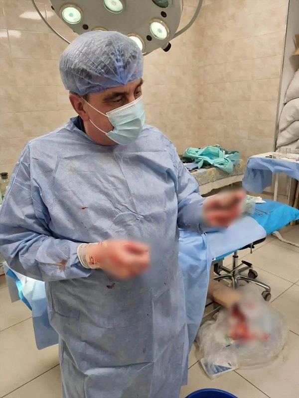 Bölge valisi Serhii Borzov, pazartesi gecesi yayınladığı  Facebook gönderisinde, "Askeri doktorlarımız, patlamamış bir VOG el bombasını bir askerin vücudundan çıkarmak için operasyon gerçekleştirdi." dedi.