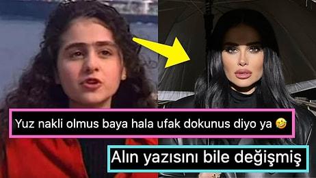 Son Haliyle Gündem Olan Azeri Kızı Günel'in Estetik Açıklaması Sosyal Medya Kullanıcılarının Diline Düştü!