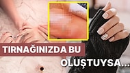 Güzellik Uzmanı Yüzünden Dünyası Başına Yıkıldı: Yaptırdığı Manikür Yüzünden Kansere Yakalanan Kadın