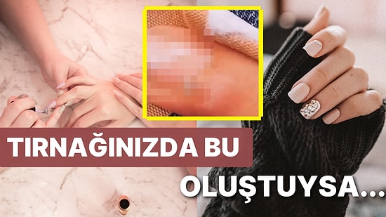 Güzellik Uzmanı Yüzünden Dünyası Başına Yıkıldı: Yaptırdığı Manikür Yüzünden Kansere Yakalanan Kadın