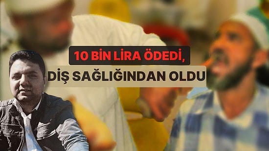 Sahte Diş Doktoru İnşaat Amelesi Çıktı! Dişleri Eskisinden Daha Kötü Oldu