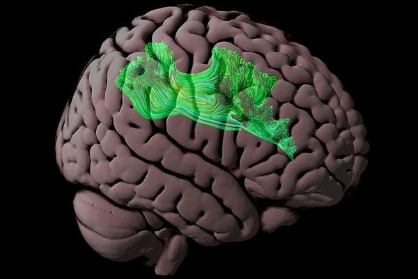 Bir dizi farklı koşulun altında yatan bir beyin ağının tanımlanmasının tedavi için önemli etkileri var.
