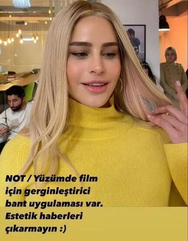 "Yüzümde film için gerginleştirici bant uygulaması var. Estetik haberleri çıkarmayın :)" açıklaması yapan Büşra Pekin, eski rol arkadaşı Zeynep Koçak tarafından tiye alındı!