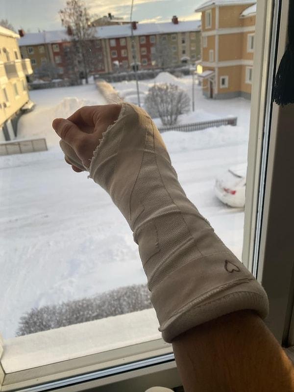 2. "İki gün önce kolumu kırdım bugün ameliyat olmam gerekiyordu ama doktorum da kolunu kırdı."