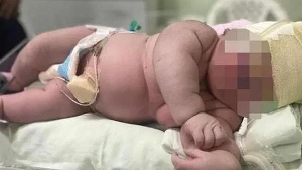 Doktorlar, bebeğin eyalette dünyaya gelen en büyük bebek olduğunu söyledi