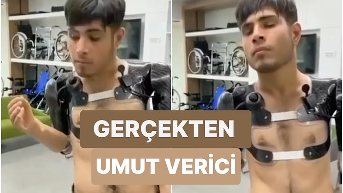 İki Kolu da Ampute Olan Gencin Protez Kollarıyla Yapabildikleri Gelecek Hakkında Umut Veriyor!