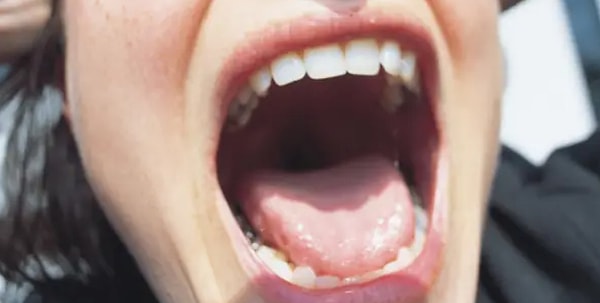 3. Клетки во рту почти такие же, как и клетки в прямой кишке