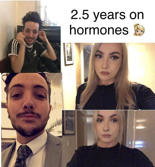 7. "Hormon tedavisinde 2 buçuk yıl"