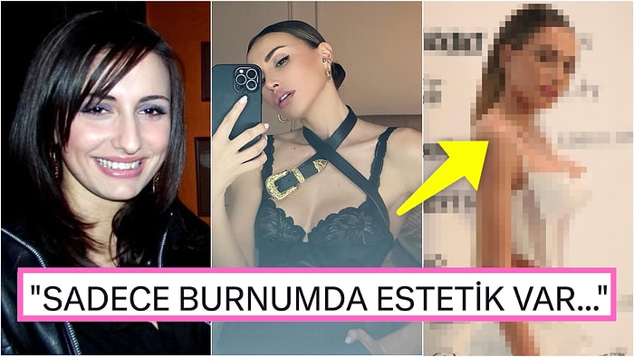 Estetikle Resmen Evrim Geçiren Mustafa Sandal'ın Eski Eşi Emina Jahovic'in Görenlere Şaşkınlık Veren Son Hali