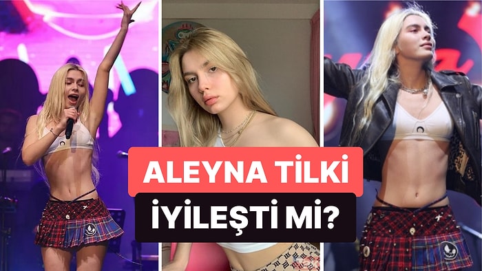 Ses Tellerinden Rahatsız Olan Aleyna Tilki Sahnelere Dönecek mi?