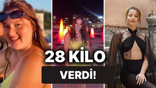 Çöp Adam'ın Yıldızı Elçin Afacan'ın Son Hâli Karşısında "Yok Artık" Demekten Kendinizi Alıkoyamayacaksınız