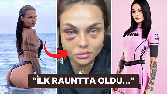 MMA'in Gözbebeği Kamila Smogulecka, İyileşme Sürecini Takipçileriyle Paylaştı!