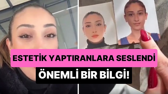 Estetik Yaptırdığı İçin Kimliğini Değiştiremeyen Kadından Önemli Bilgilendirme!