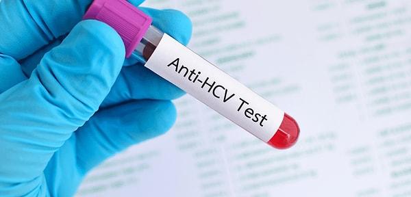Anti HCV Nedir?
