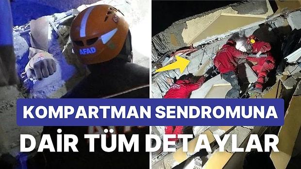 Kahramanmaraş'taki Deprem Sonrası Görülebilecek Kompartman Sendromu Nedir? Kompartman Sendromu Belirtileri