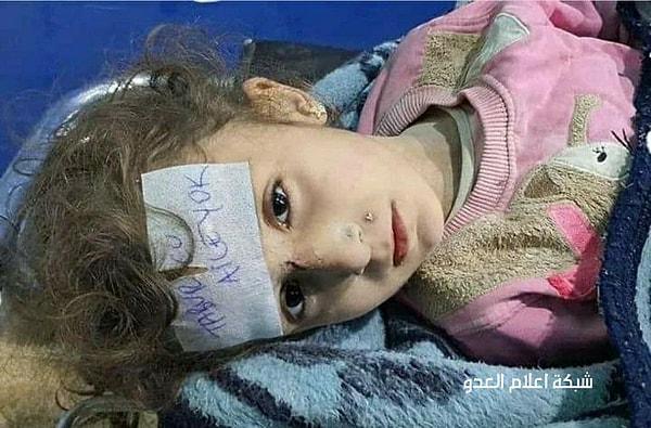 Suriye uyruklu küçük yavrumuzun alnında 'Ailesi yok' yazıyor...