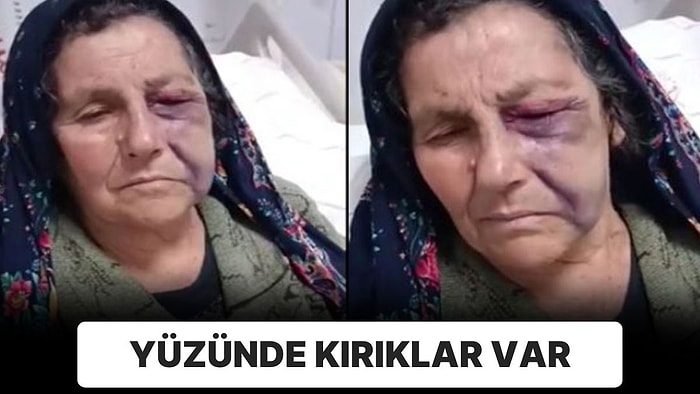 Yardım Derneği Yöneticisi 70 Yaşındaki Depremzedeyi Darbetti