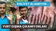 Bu Ailedeki Erkeklerin Parmak İzi Yok! Bangladeşli Sarker Ailesinin Adermatoglifiya ile İmtihanı