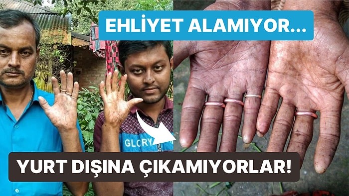 Bu Ailedeki Erkeklerin Parmak İzi Yok! Bangladeşli Sarker Ailesinin Adermatoglifiya ile İmtihanı