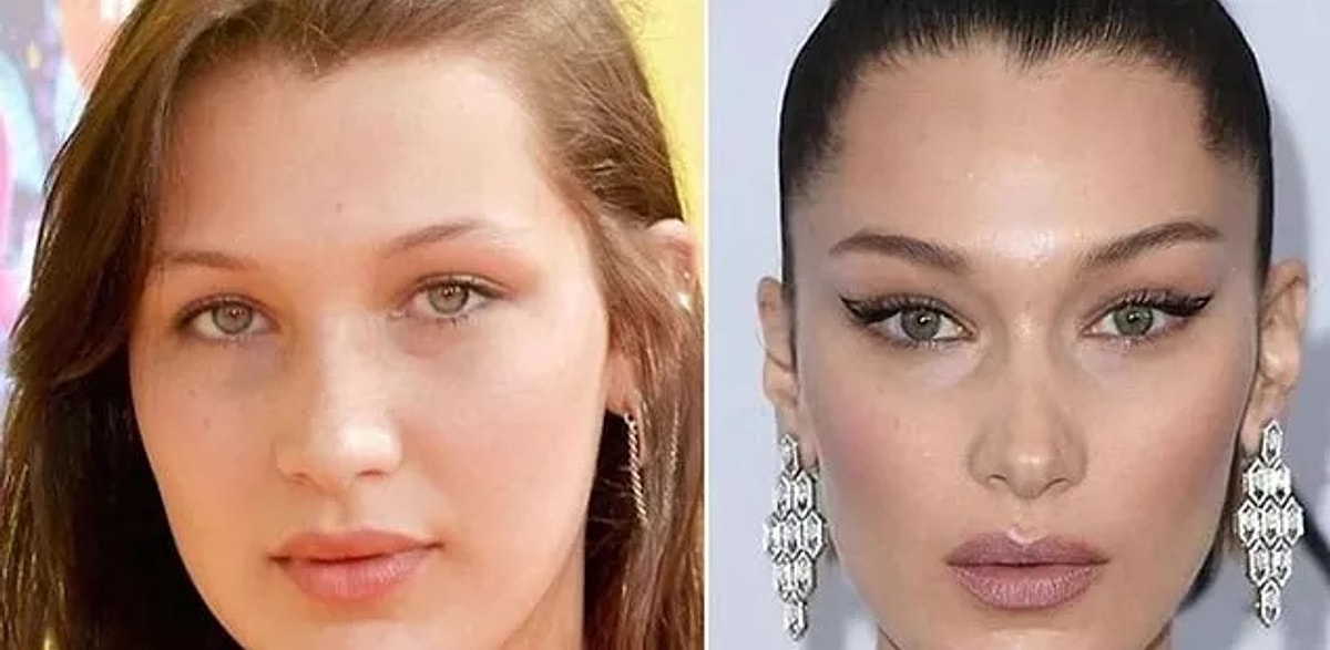 These Will Be the 7 Biggest Plastic Surgery Trends of 2023 - Onedio