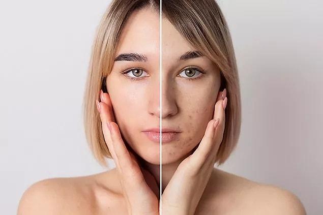 Did you know that when you don't let your skin breathe, you will face negative consequences?