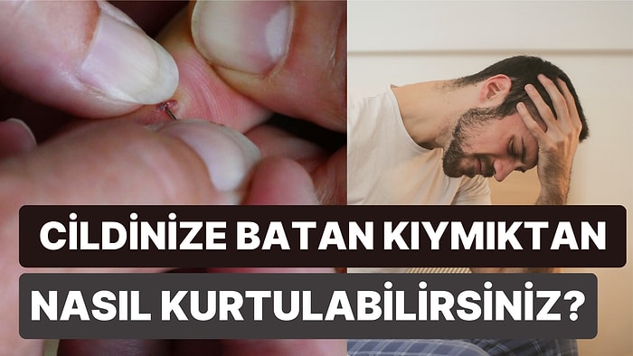 Cildinize Batan Kıymığı Çıkarabilmek İçin Kullanabileceğiniz En Acısız 6 Yöntem