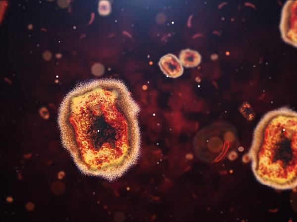 Yeni bir çalışma, et yiyen mpox virüsünün özellikle HIV ile yaşayan insanlar için ölümcül olduğunu buldu.