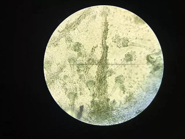 One of the fungi considered to pose the most significant risk is "Aspergillus fumigatus", a common mold found in many homes, which can cause "chronic and acute lung disease" and can be fatal.