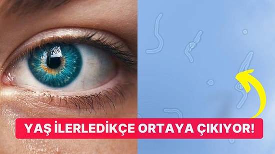 Özellikle Yeni Uyandığımızda Neden Gözümüzün Önünde Uçuşan Nesneler Görürüz?