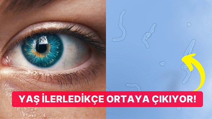 Özellikle Yeni Uyandığımızda Neden Gözümüzün Önünde Uçuşan Nesneler Görürüz?