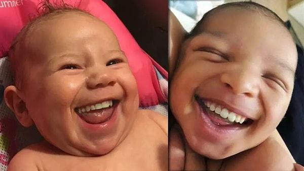 9. Her 2.000 bebekten yaklaşık birinin doğduğunda dişleri vardır.