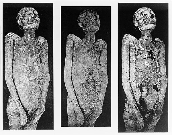 2. Antik Mısır'da otopsi yapıldığına dair kanıtlar da var!