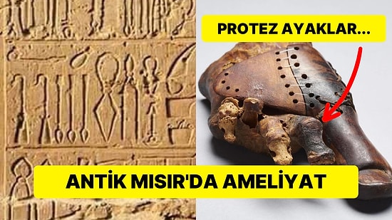 Antik Mısır'da Ameliyatlar Nasıl Gerçekleşiyordu?