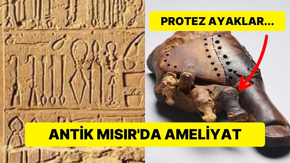 Antik Mısır'da Ameliyatlar Nasıl Gerçekleşiyordu?