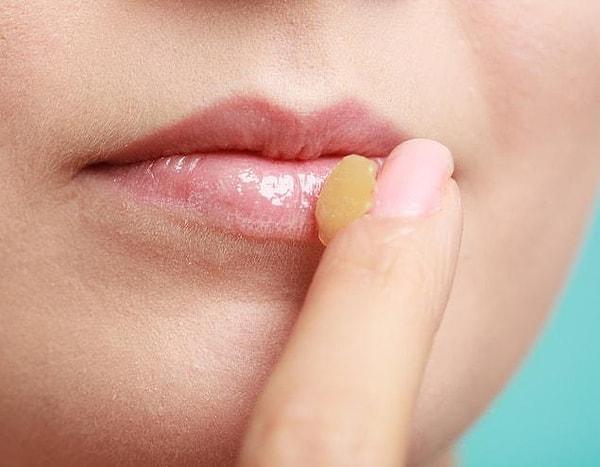 7. Daily use of Vaseline will be very good for your lips.