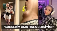 Kanser Tedavisini Ödemek İçin Bir Yetişkin Sitesine İçerik Üreten Kadın: "Erkekler Kel Görünümü Seviyor!"