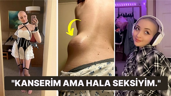 Kanser Tedavisini Ödemek İçin Bir Yetişkin Sitesine İçerik Üreten Kadın: "Erkekler Kel Görünümü Seviyor!"