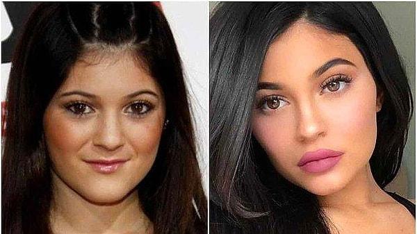 Son zamanlarda ismi Selena Gomez ile geçen bir diğer ünlü Kylie Jenner'ın da estetiksiz halini görmeyen yoktur!