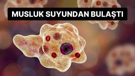 Musluk Suyundan Bulaştı: Beyin Yiyen Amip Nedeniyle Bir Kişi Daha Hayatını Kaybetti