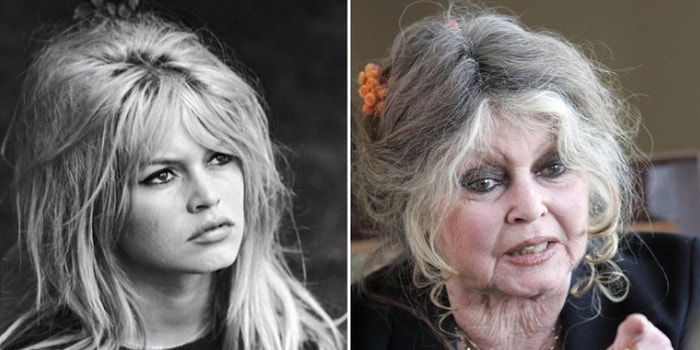 10 не самых лучших трансформаций знаменитостей, которые точно не оставят вас равнодушными