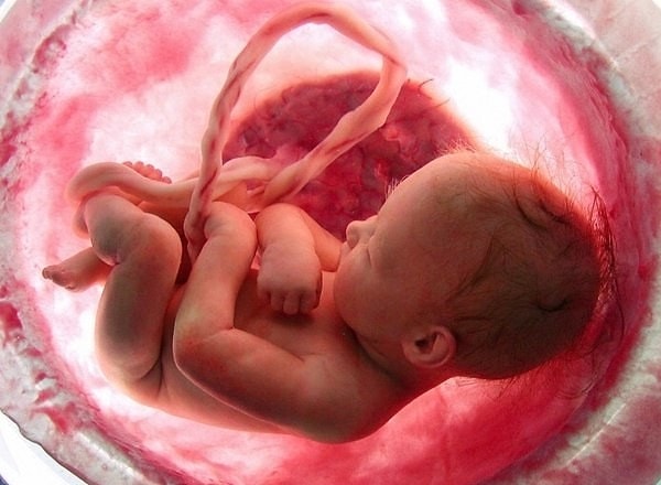 11. Колумбийка носила мумифицированный плод ребенка в своей уретре около 40 лет.