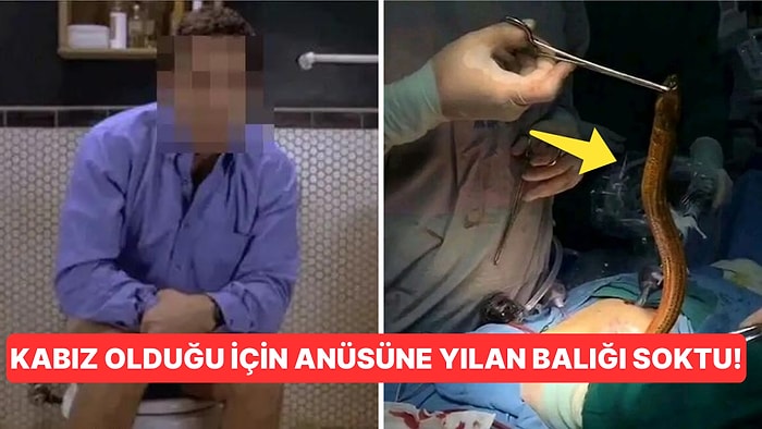 Kabız Olduğu İçin Anüsüne Kendi Rızasıyla Yılan Balığı Sokan Adamın Saç Baş Yoldurtan Tuhaf Hikayesi