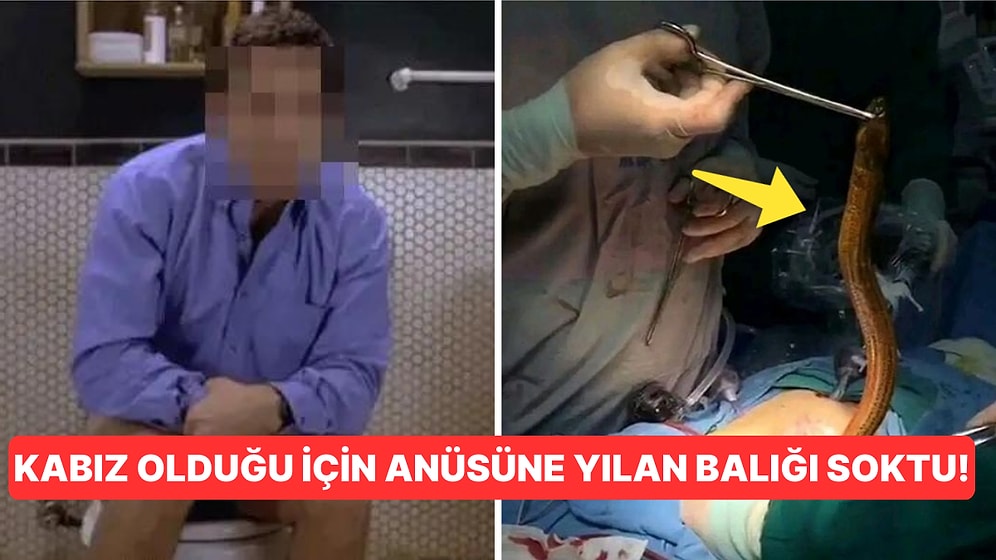 Kabız Olduğu İçin Anüsüne Kendi Rızasıyla Yılan Balığı Sokan Adamın Saç Baş Yoldurtan Tuhaf Hikayesi