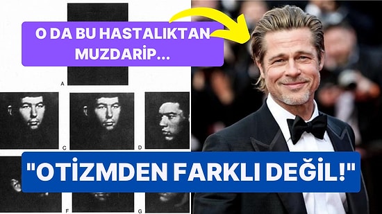 Yapılan Son Araştırmalar Sonucunda Yüz Körlüğü Yaşayan Kişilerin Sayısı Sandığınızdan Fazla Olabilir